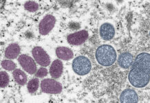 Does Florida’s lack of monkeypox precautions impact schools?